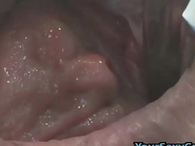 Extreme anal and pussy prolapse after bizarre dp